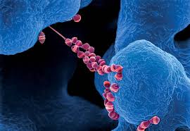 Viêm màng não do Streptococcus suis - Hình ảnh minh họa